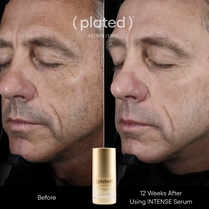 ( plated )™ Skin Science INTENSE Serum 15 mL