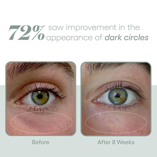 Plated_skin_science_Exosome_EYE_Serum_Plated-before_after