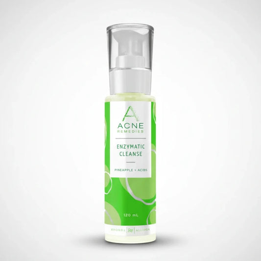 Rhonda Allison Acne Remedies Enzymatic Cleanse bottle with green label on light grey background
