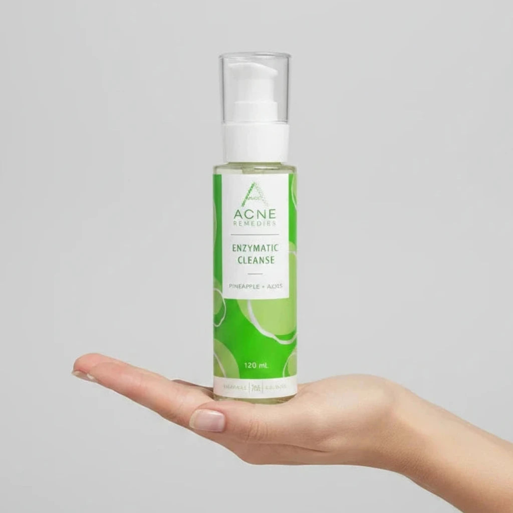 Rhonda Allison Acne Remedies Enzymatic Cleanse bottle with green label on light grey background held in palm of hand