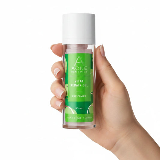 Acne Remedies Vital Repair Gel bottle on a white background with hand holding product
