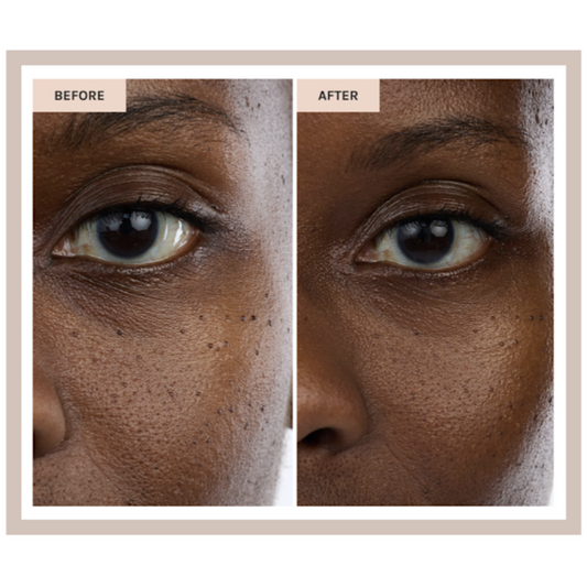 Kari Gran Moisture Milk Deep Hydration | Pro-Ceramide + Niacinamide Mist
