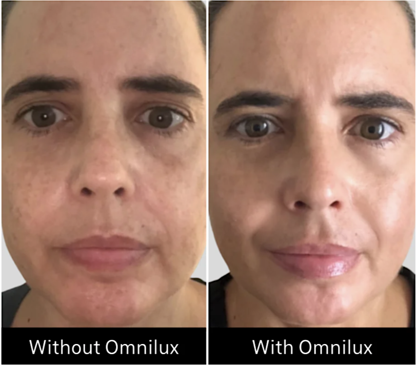 Omnilux Contour Flexible LED FACE Mask