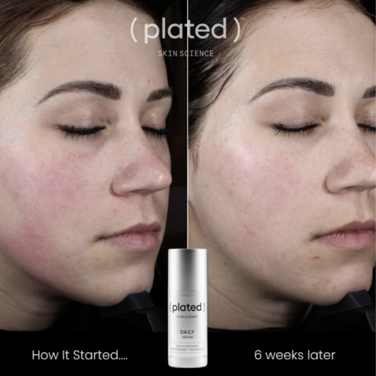 Before and after comparison of a woman's face with 'plated' skincare product shown.
