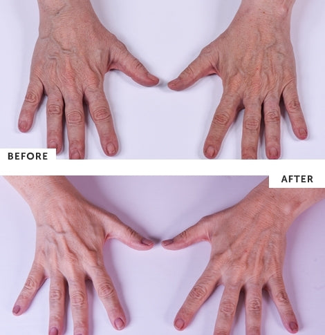 SilcSkin Hand Treatment Cream 3 oz